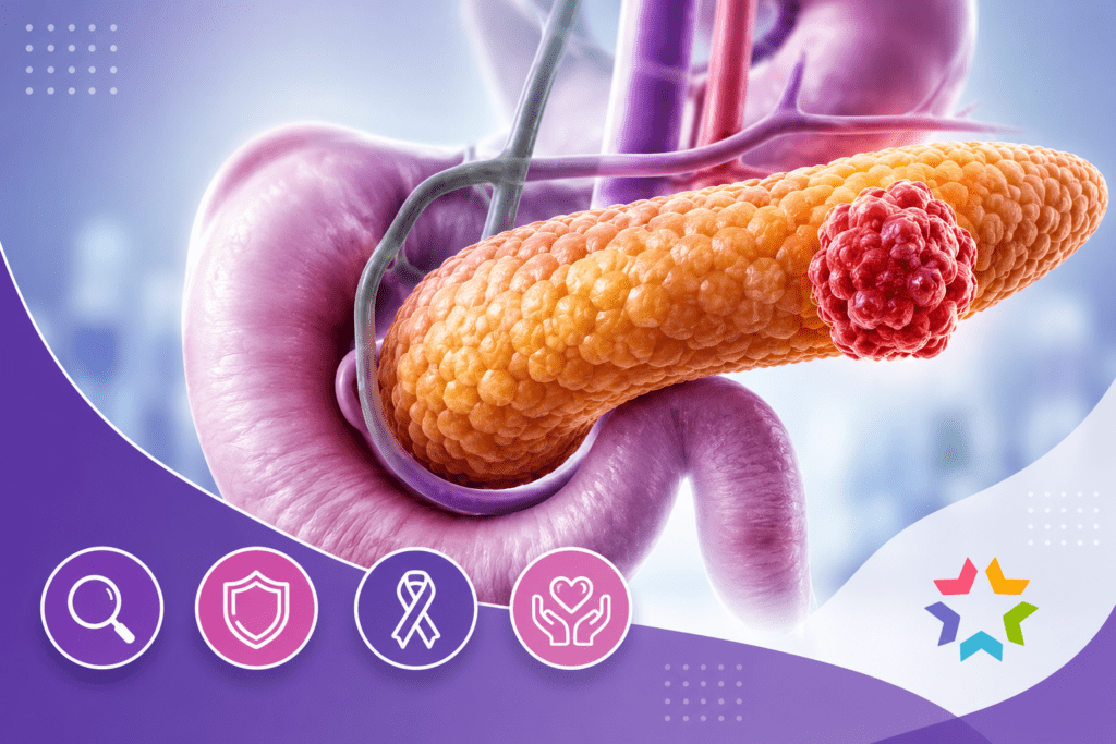 Cancer du pancréas : symptômes, diagnostic, traitements et espoirs de la recherche