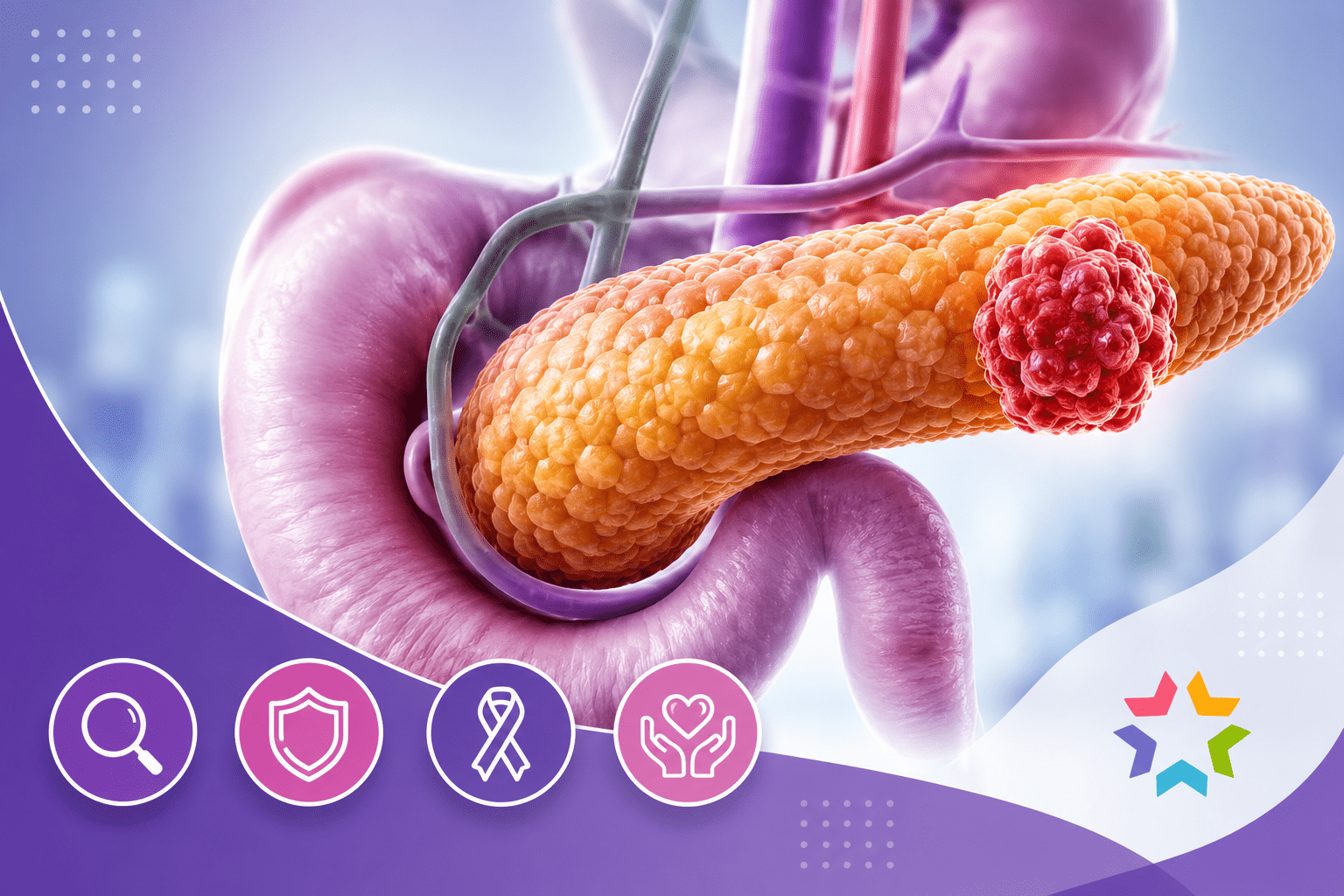 Cancer du pancréas : symptômes, diagnostic, traitements et espoirs de la recherche